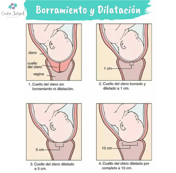 contracciones-motor-de-parto